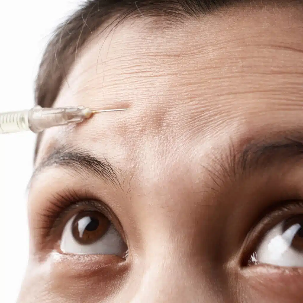 A person receiving Forehead Line Treatments with Dysport and/or Botox