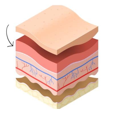 A diagram of layers of skin