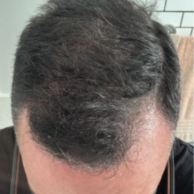 After