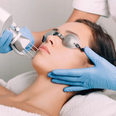 CO2 Laser Resurfacing Near Me