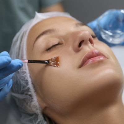 Chemical Peel near me evolvmd med spa milwaukee