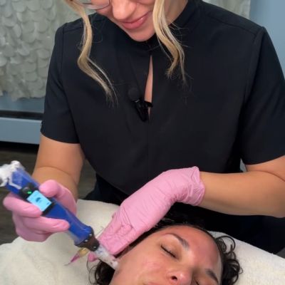 EvolvMD Mlwaukee aesthetician doing a mesoneedling treatment