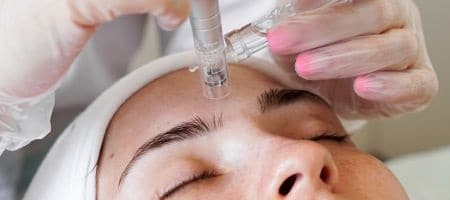 RF MicrOne of the things we love most about this peel is that you can combine theBioRePeelCl3 with other treatments like Dermaplaning, Hydrafacials, and Microneedling Rejuvapen NXT to target and treat the signs of aging. oneedling Milwaukee Wi