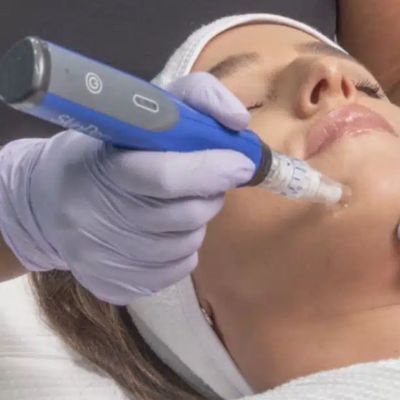 SkinPen Precision Elite Microneedling Near me Milwaukee wi Evolvmd med spa