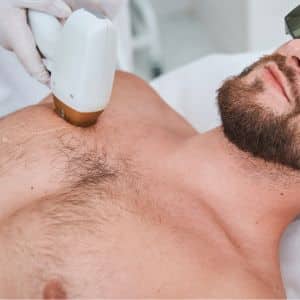 body laser hair removal chest near me