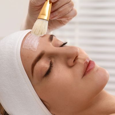 chemical peels near me