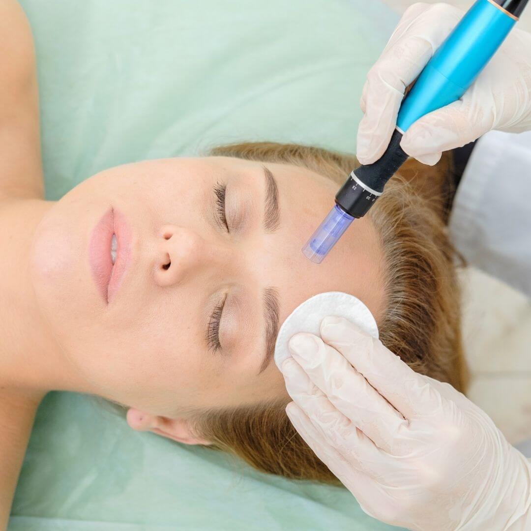 Microneedline Rejuvapen NXT at EvolvMD MedSpa to hydrate and plump dull winter skin.