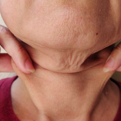 how to rid of double chin near me EvolvMD Milwaukee
