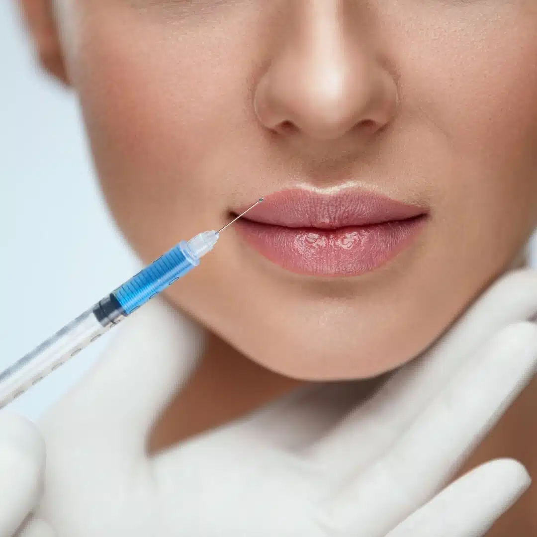 Injectables & Filler Best Lip Injections at EvolvMD Milwaukee WI