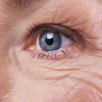 mermaid facial for wrinkle treatment near me