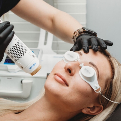 woman with glowing skin getting an aerolase neo elite treatment at evolvmd with Evolvu membership milwuakee